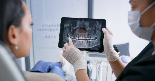 Licensed Tooth Extraction service in Chesterfield County County, SC - Smile Center Dentistry